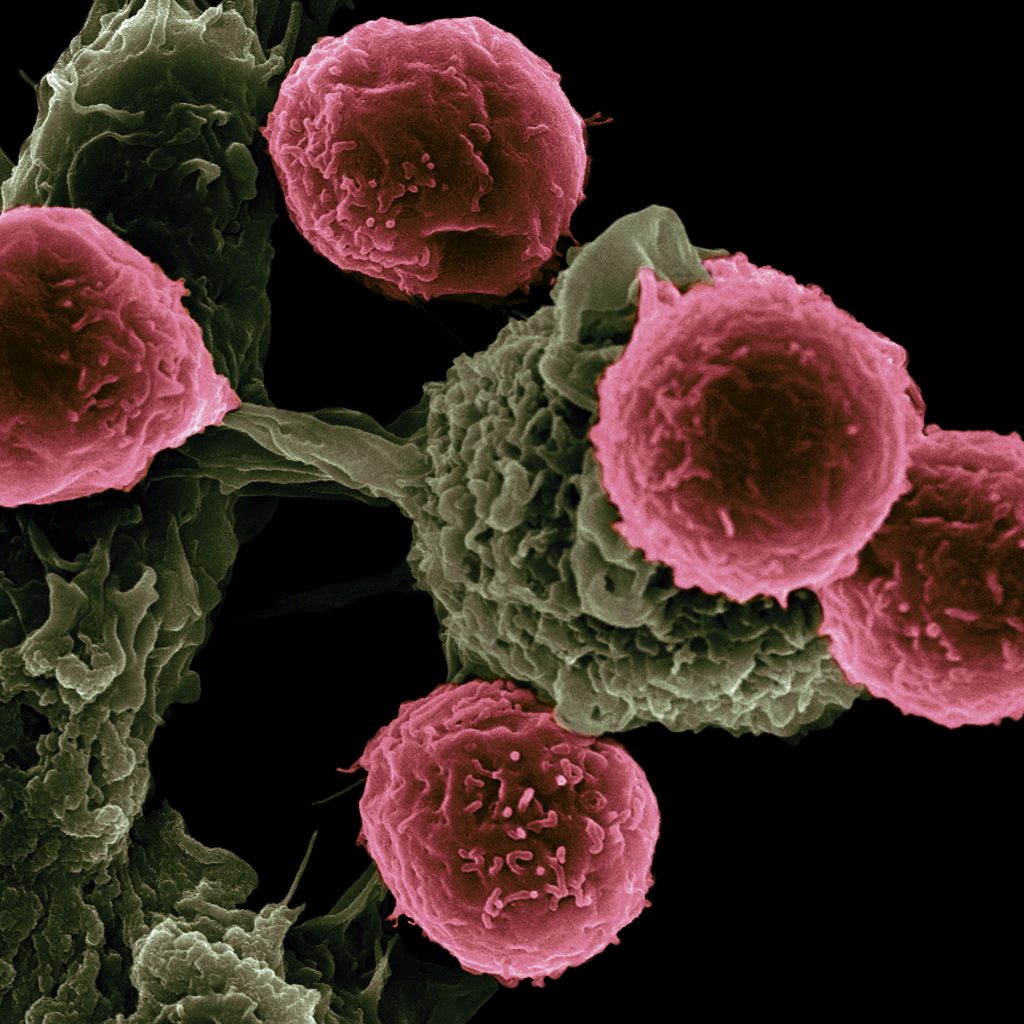 Vaccine Based Immunotherapy 1024x1024 1