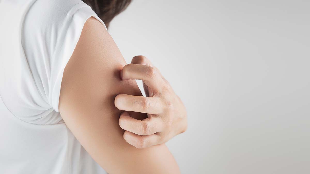220712174159 derma